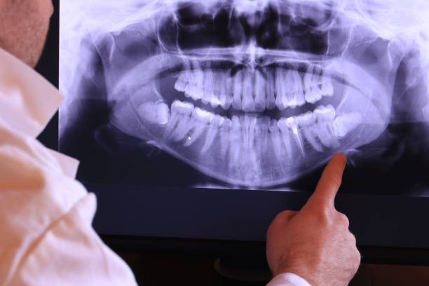 Best Emergency Dental Care for Sports Injuries in Wellington, KS